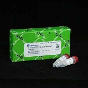 Paraffin-Tissue-Section---Human-Lung-Tumor:-Small-Cell-Carcinoma